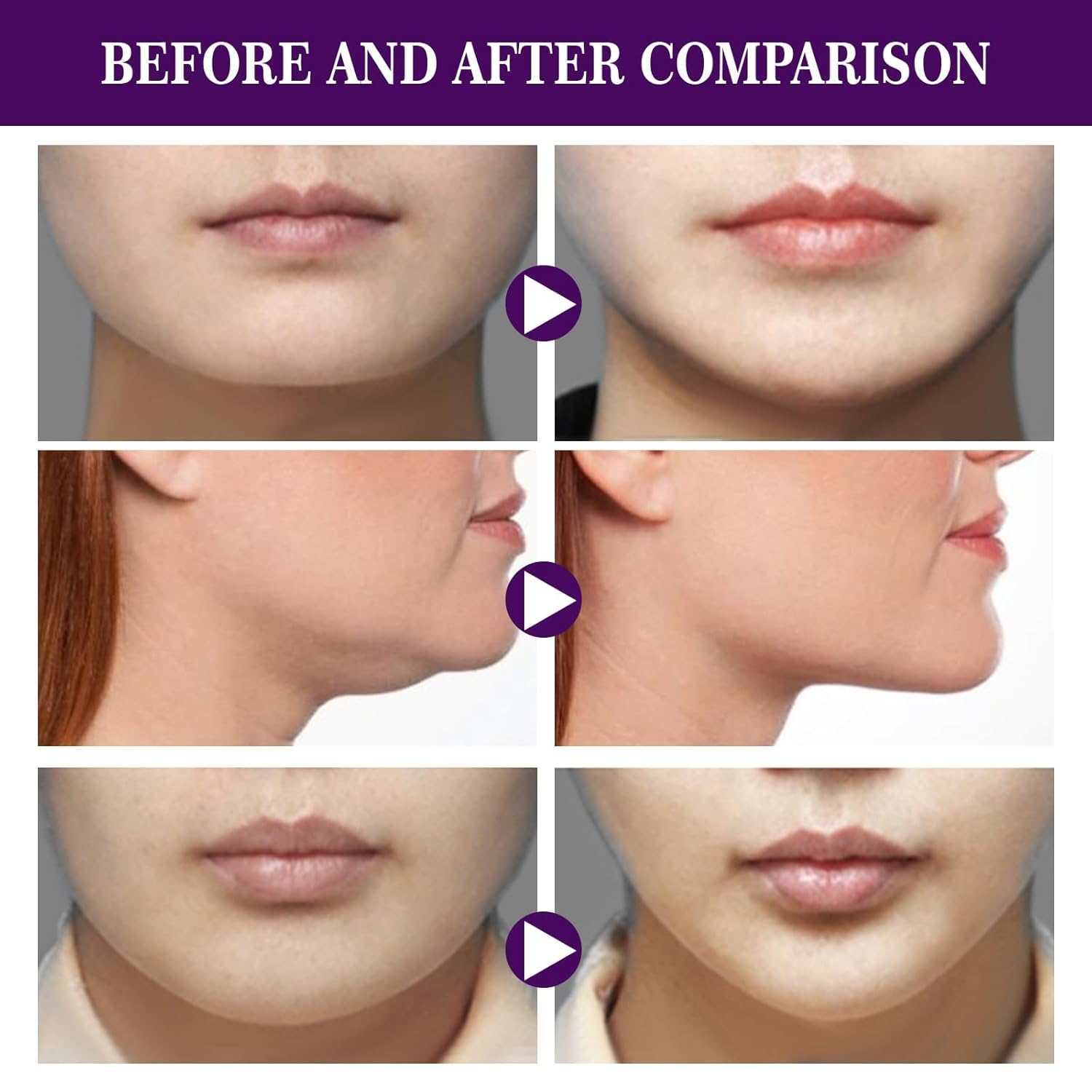 Set de stickere invizibile pentru lifting facial InstaLift, 60 buc