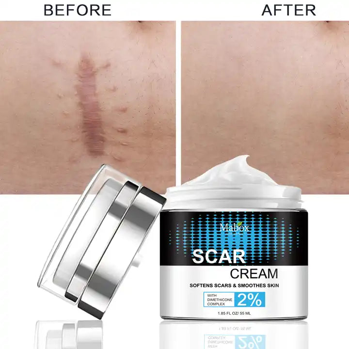 Crema cicatrizanta Mabox Scar Cream, Complex Dimeticona 2%, Aloe Vera, Tocoferol (Vitamina E), 55 ml