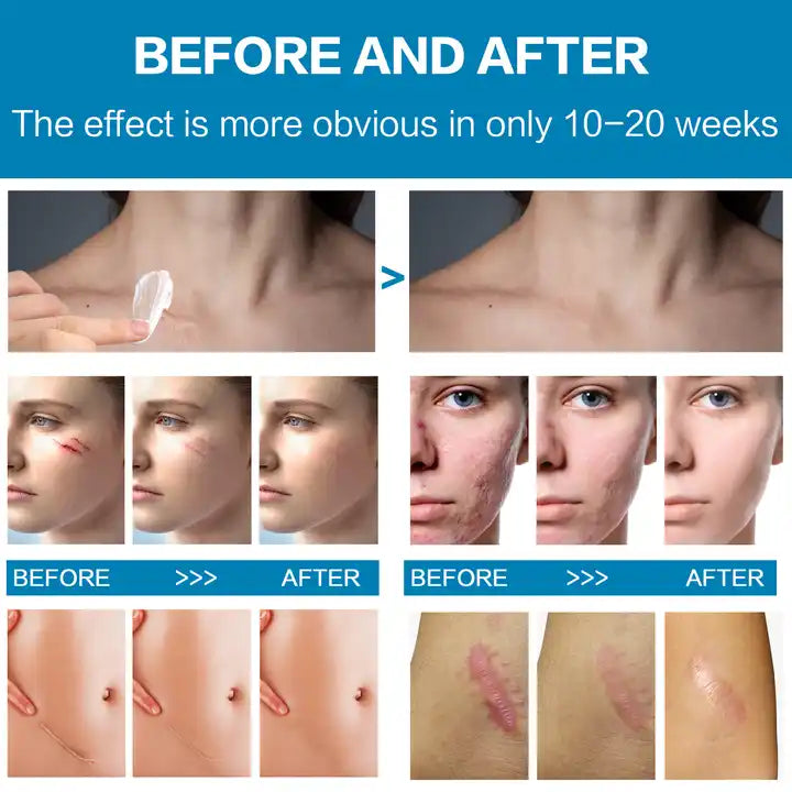 Crema cicatrizanta Mabox Scar Cream, Complex Dimeticona 2%, Aloe Vera, Tocoferol (Vitamina E), 55 ml