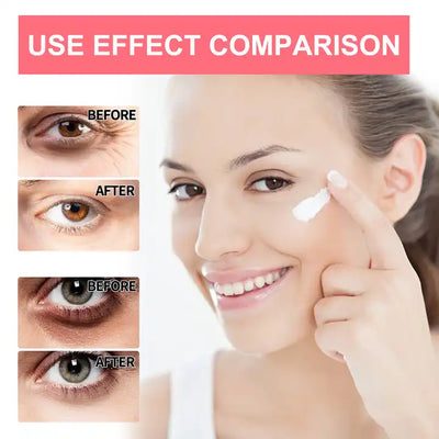 Stick anti-imbatranire cu retinol, pentru zona ochilor si buze, Eelhoe, 3g