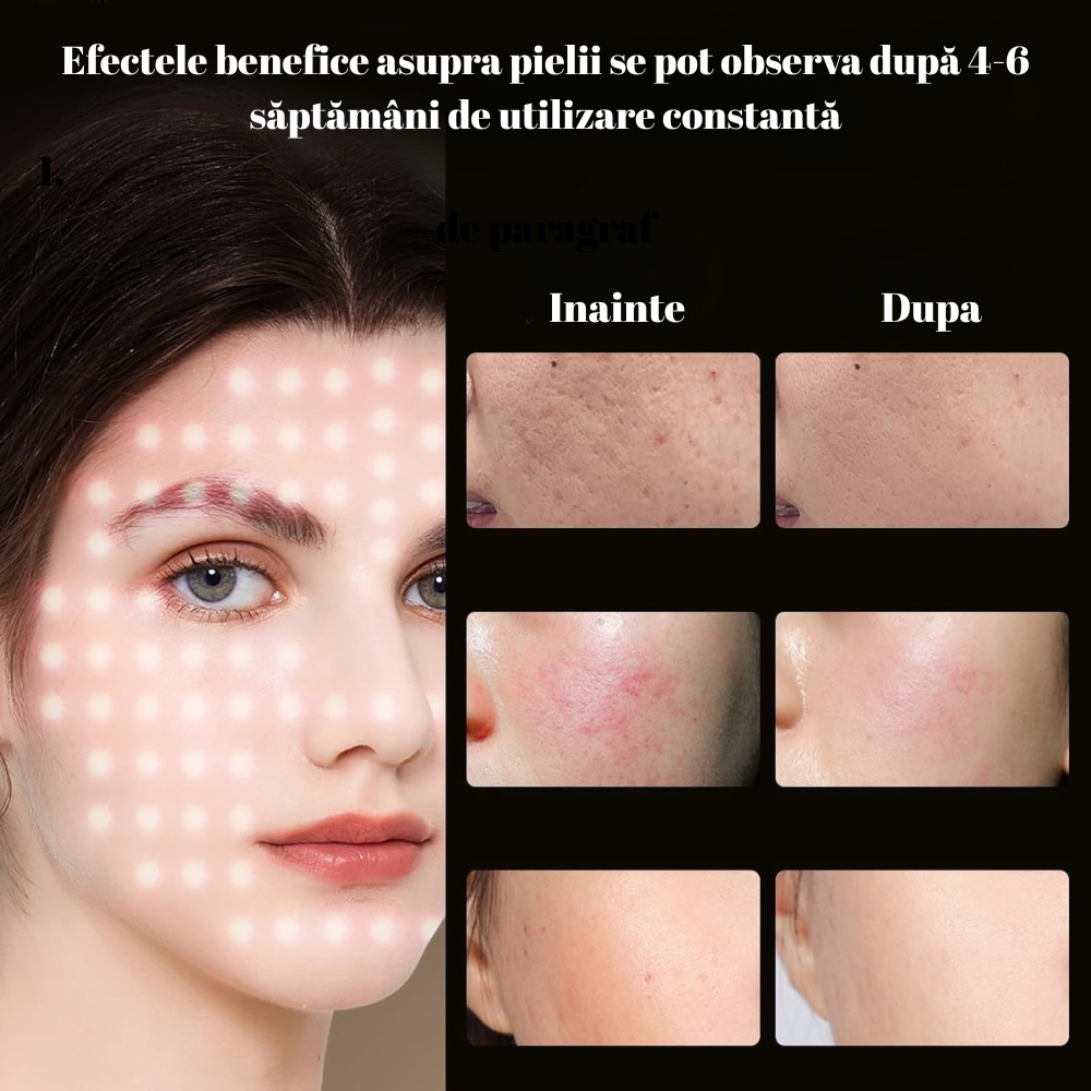 Masca Faciala din Silicon, SkinLight, Fototerapie cu 96 leduri 3D, 288 de fascicule  pentru rejuvenare și tratarea acneei