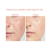 Masca Faciala din Silicon, SkinLight, Fototerapie cu 96 leduri 3D, 288 de fascicule, 7 lumini fotonice