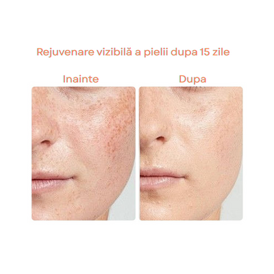 Masca Faciala din Silicon, SkinLight, Fototerapie cu 96 leduri 3D, 288 de fascicule, 7 lumini fotonice