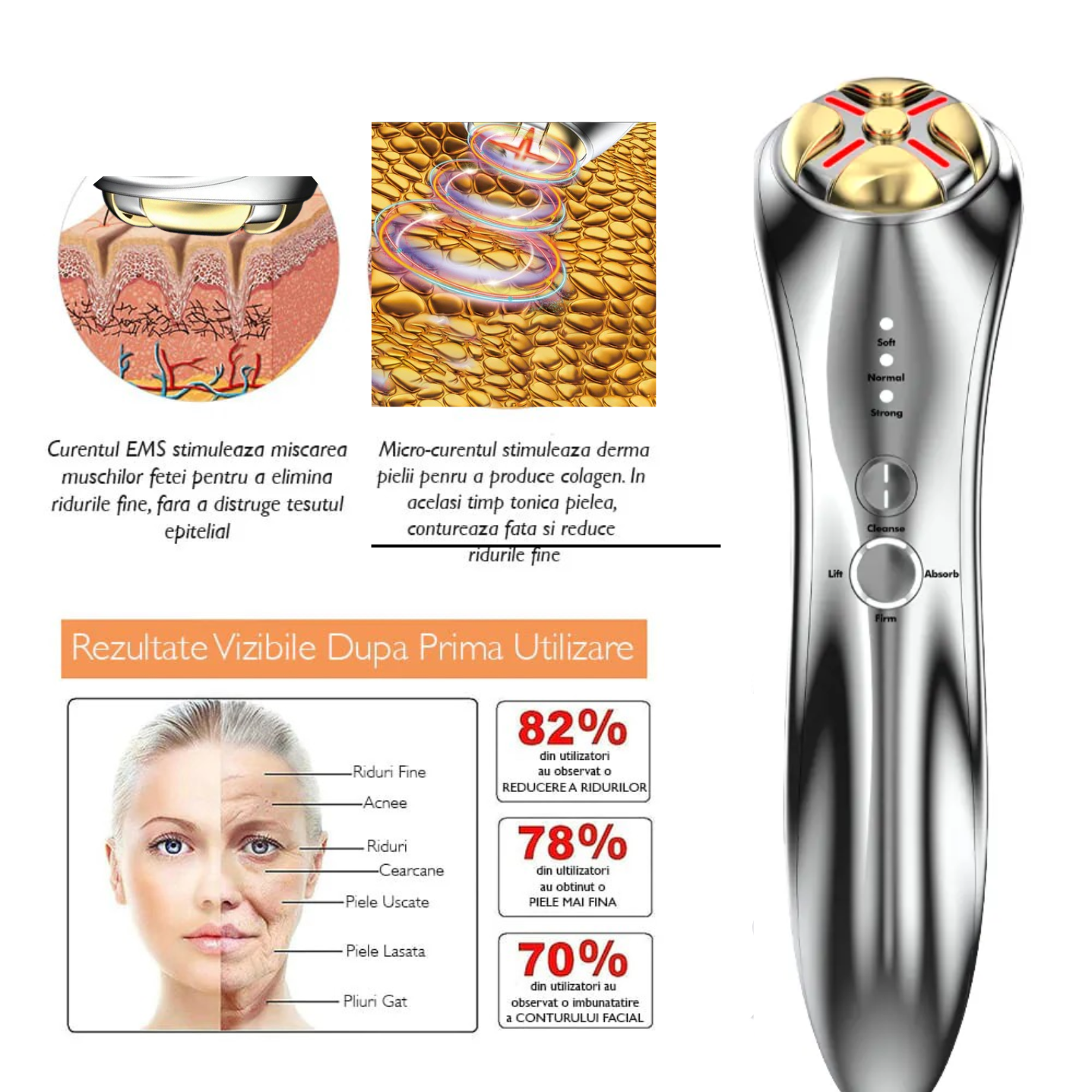 Aparat pentru masaj facial, Lifting si Intinerire cu Tehnologie Avansata RF 1MHZ si EMS, Photon Skin