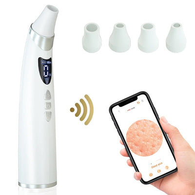 Aspirator smart,  pentru puncte negre, cu vacuum, Display , Wi-Fi APP A-Z Beauty Skin