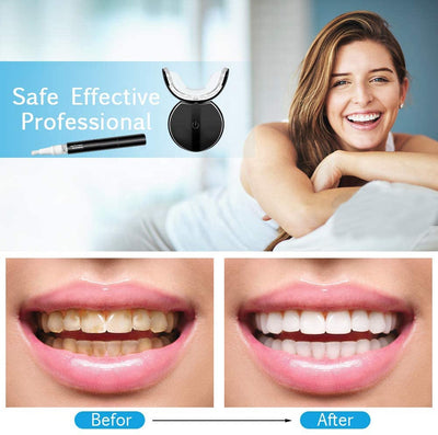 Set premium pentru albirea dintilor, GLORY SMILE