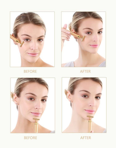 Aparat lifting facial, 24 K Beauty Energy Bar A-Z Beauty Skin