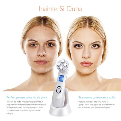 Aparat tratament facial, Mezoterapie 5 in 1 A-Z Beauty Skin