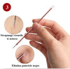Trusa pentru extractia punctelor negre 4 piese A-Z Beauty Skin
